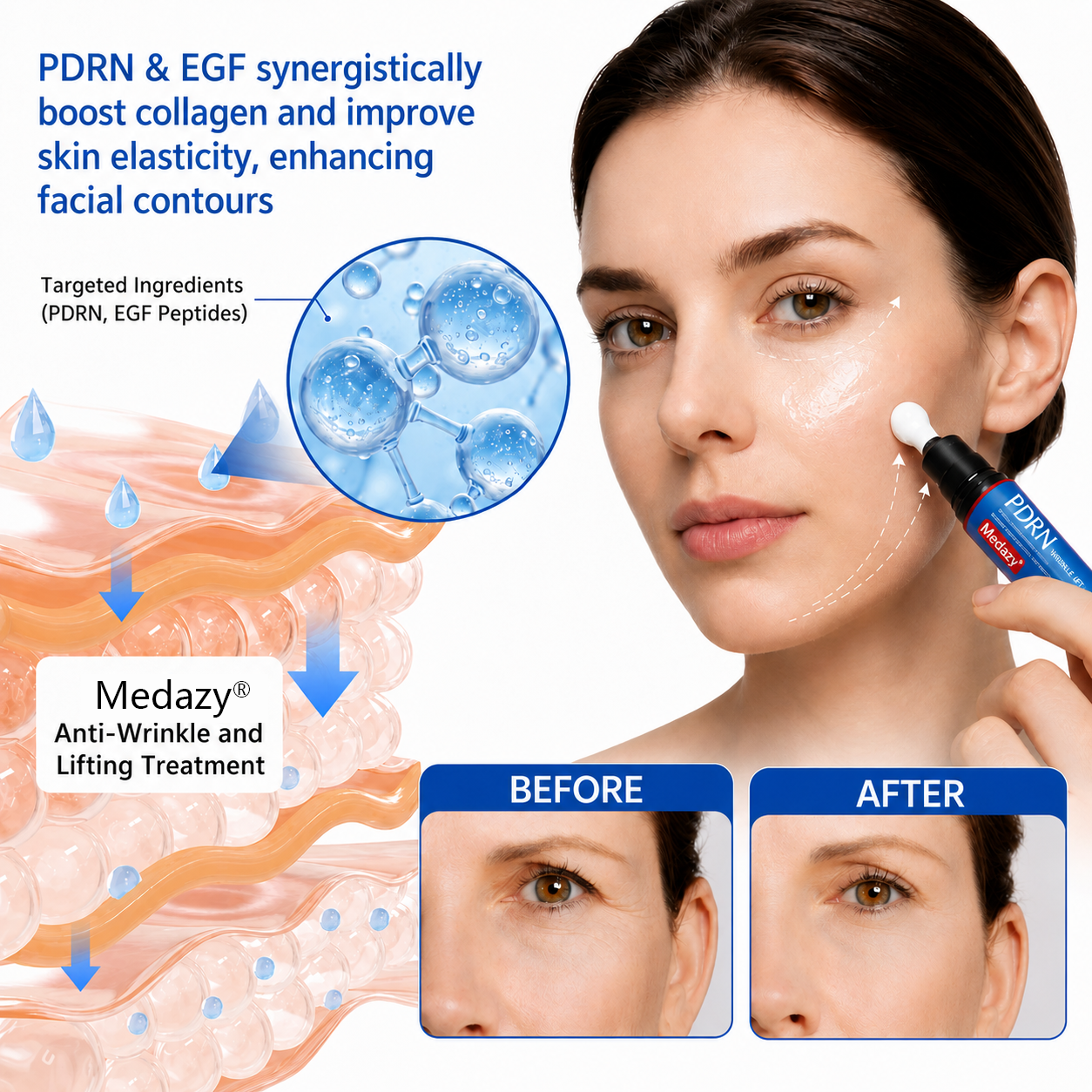 🥈🎁UK HOT SALE Medazy® PDRN Anti-Wrinkle Shot – Lift & Firming Cream