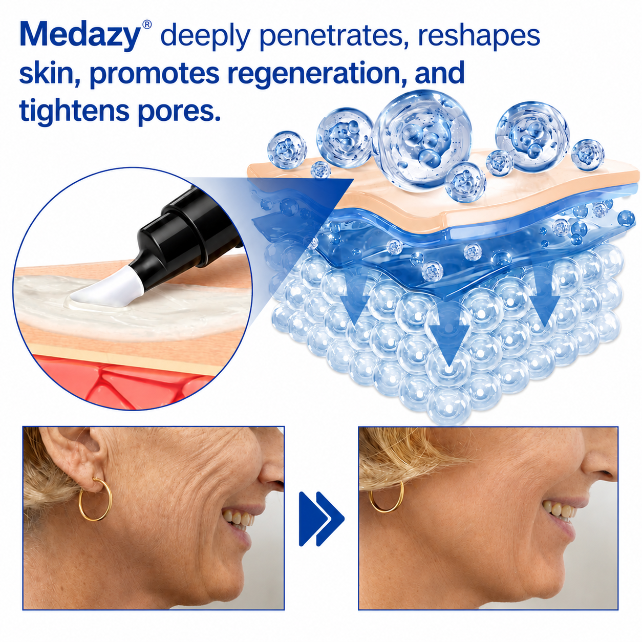 🥈🎁UK HOT SALE Medazy® PDRN Anti-Wrinkle Shot – Lift & Firming Cream