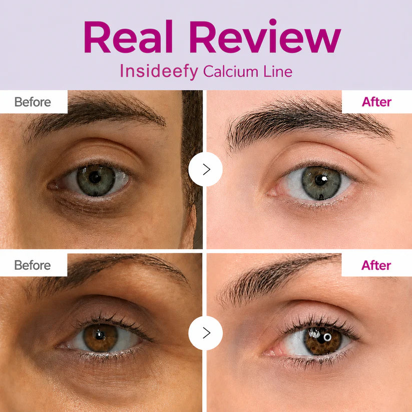 🔥LAST DAY 60% OFF!!Insideefy Korean Calcium Dark Spot Eye Cream