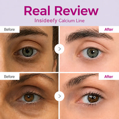 🔥LAST DAY 60% OFF!!Insideefy Korean Calcium Dark Spot Eye Cream