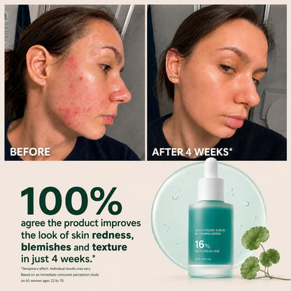 Anchoic Acid Soothing Serum