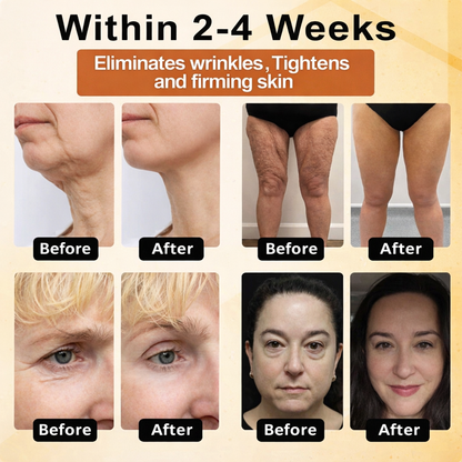 Bodilighht Bee Advanced Multi-Action Renewal Cream