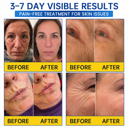 🥈🎁UK HOT SALE Medazy® PDRN Anti-Wrinkle Shot – Lift & Firming Cream