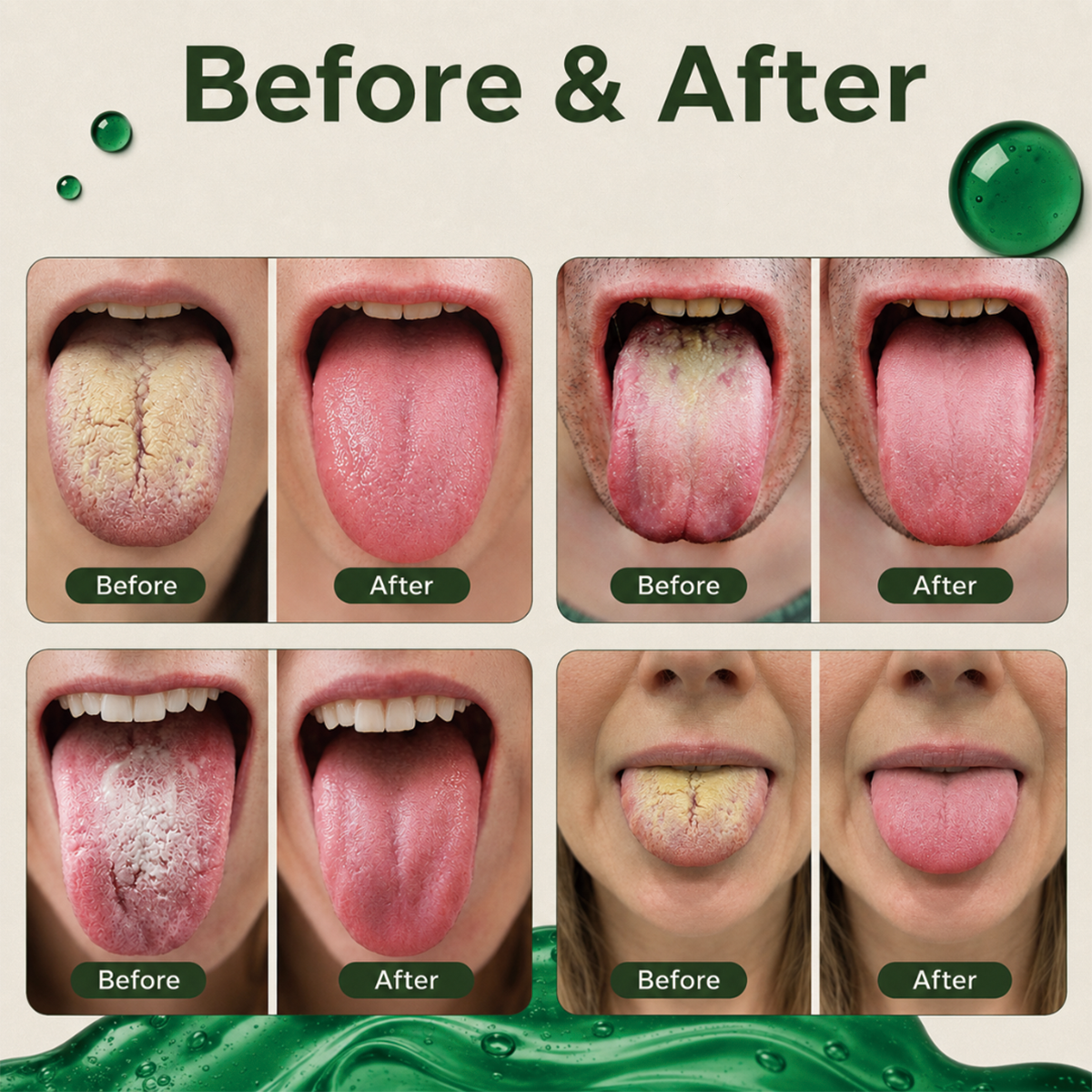 Anti-Bad Breath Herbal Gel Supplement by Laobingguner™