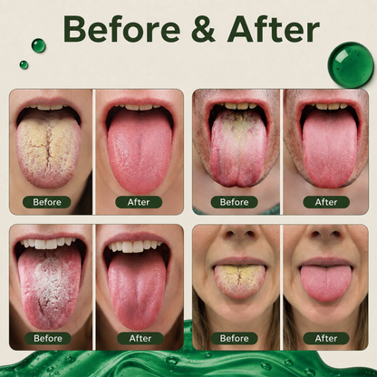Anti-Bad Breath Herbal Gel Supplement by Laobingguner™