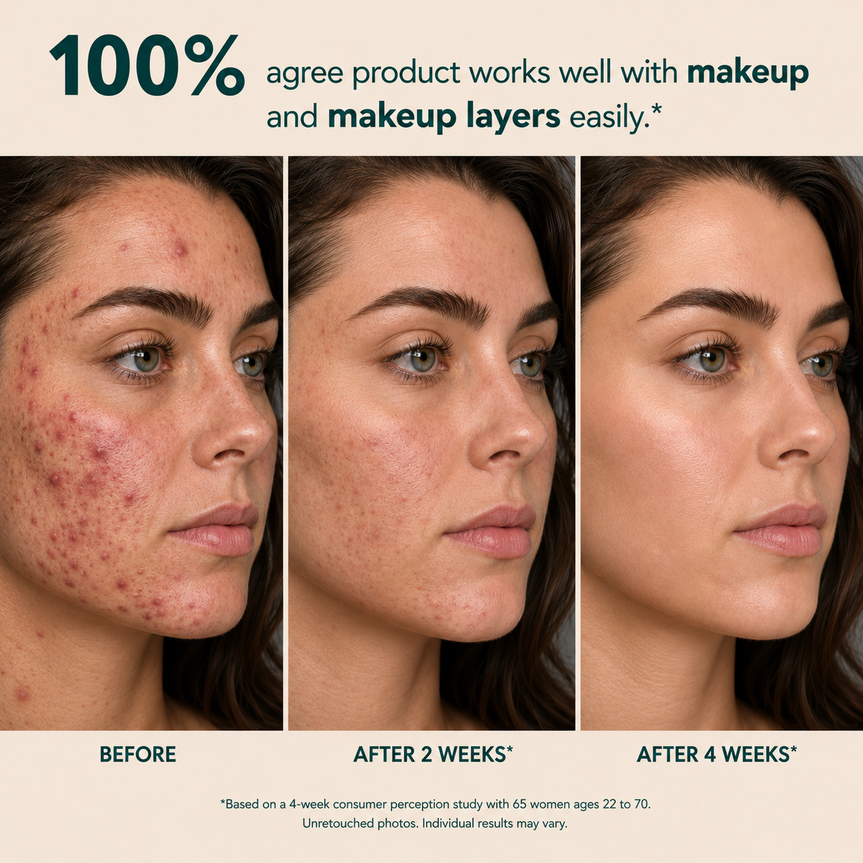 Anchoic Acid Soothing Serum