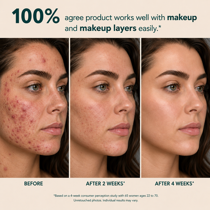 Anchoic Acid Soothing Serum