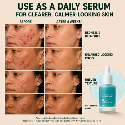 Anchoic Acid Soothing Serum
