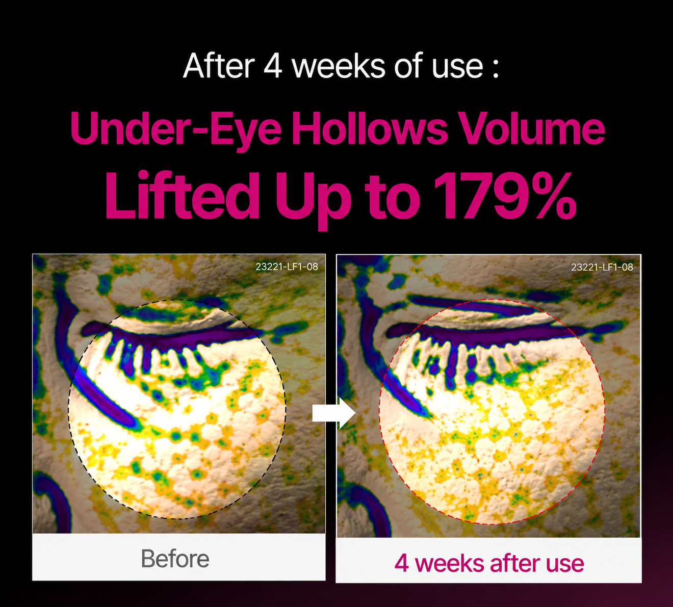 🔥LAST DAY 60% OFF!!Insideefy Korean Calcium Dark Spot Eye Cream