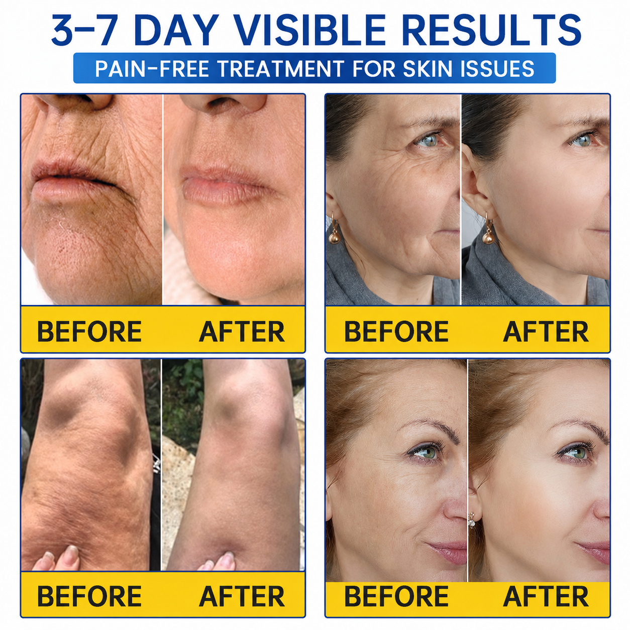 🥈🎁UK HOT SALE Medazy® PDRN Anti-Wrinkle Shot – Lift & Firming Cream