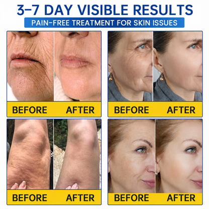 🥈🎁UK HOT SALE Medazy® PDRN Anti-Wrinkle Shot – Lift & Firming Cream