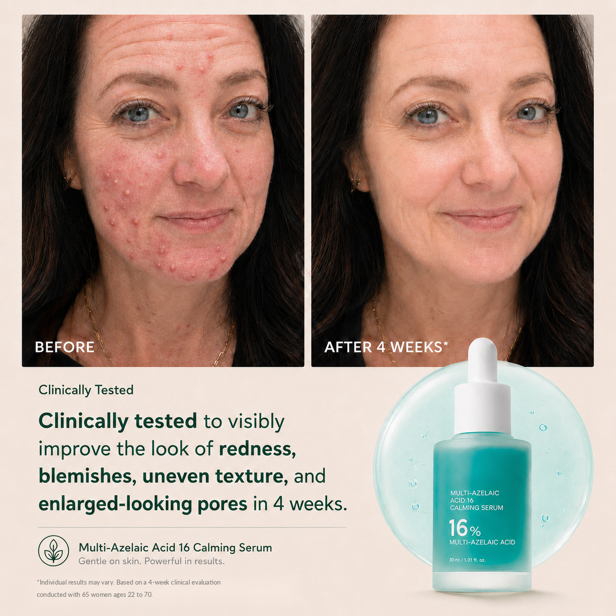 Anchoic Acid Soothing Serum