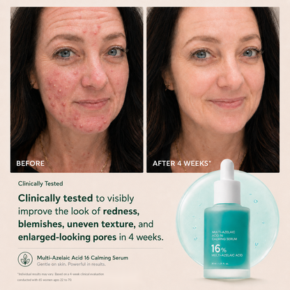 Anchoic Acid Soothing Serum